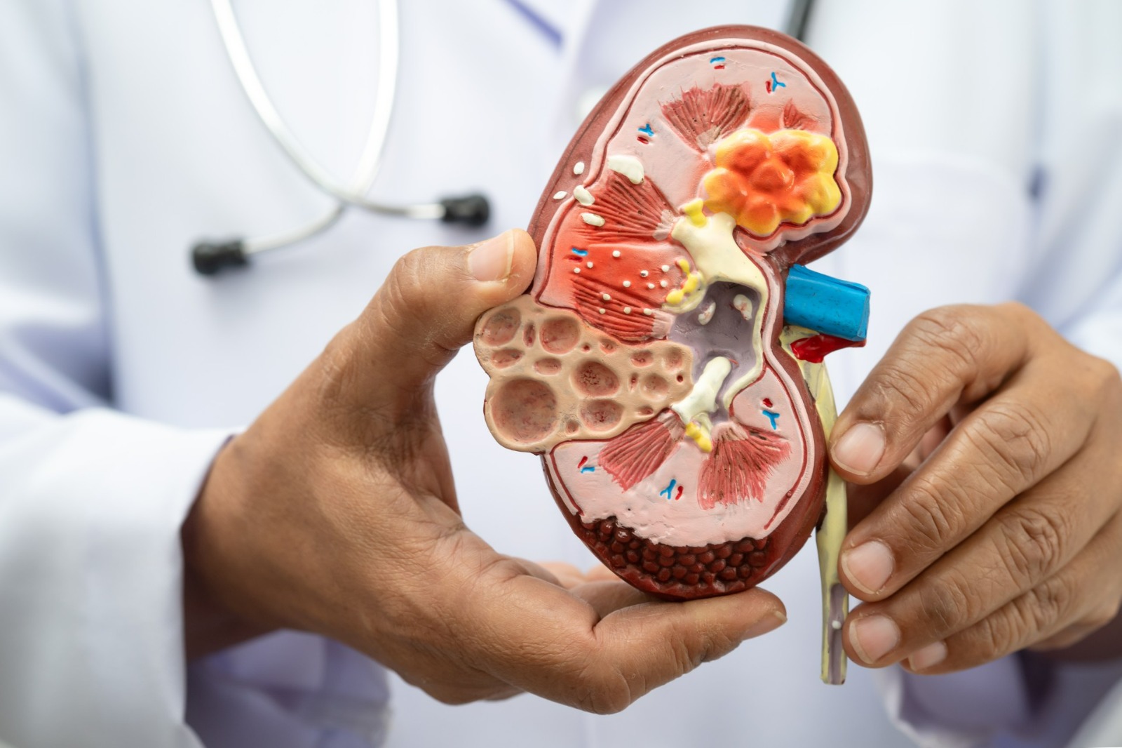 Nefróloga de Cleveland Clinic asegura que chequeos médicos son claves para proteger salud renal